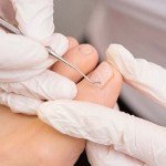 En Güvenilir El Ayak Bakımı Bakırköy Klinikleri