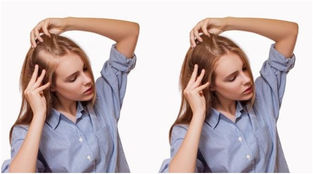Kadınlarda Saç Ekimi Nasıl Yapılır?